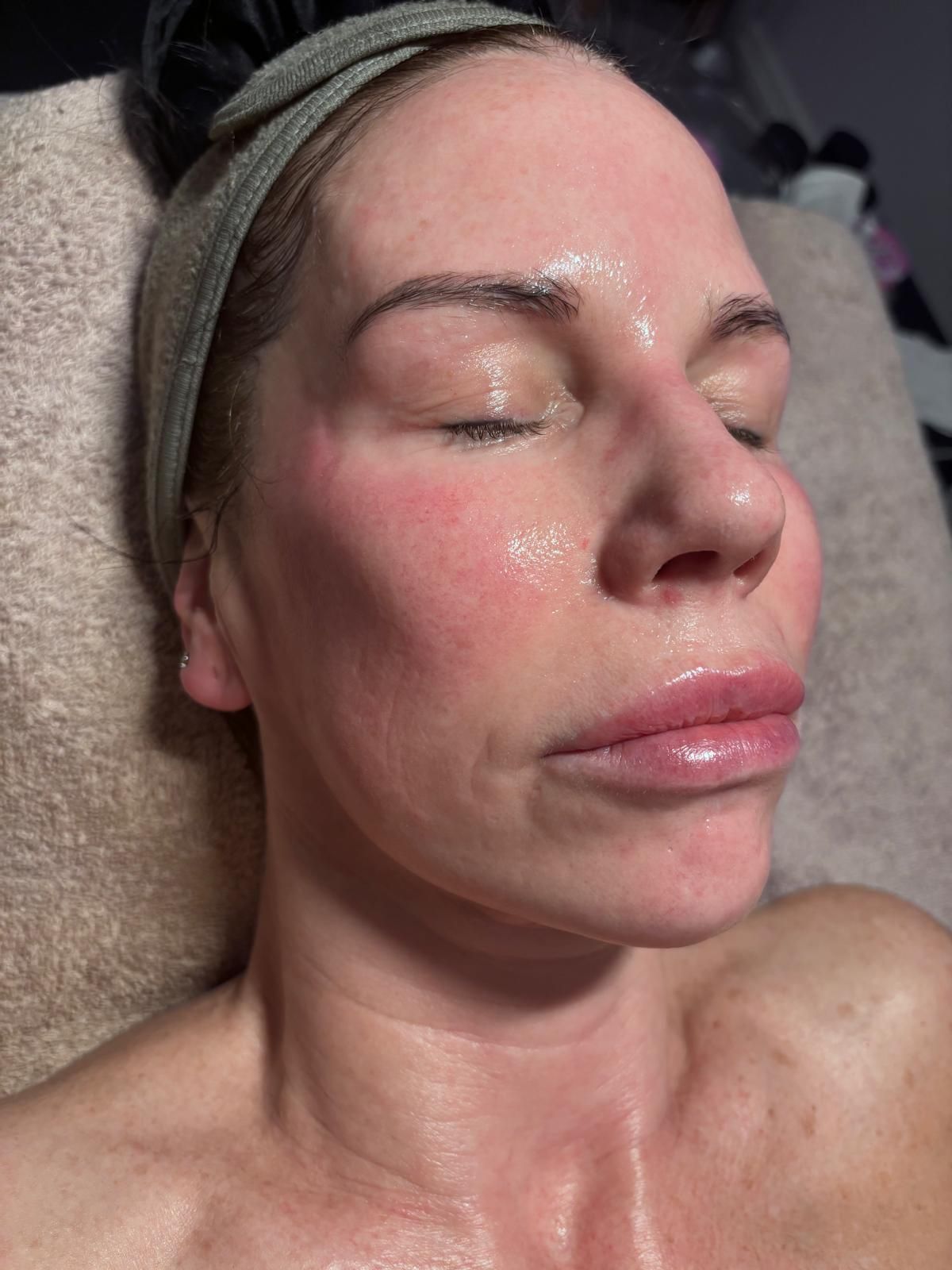 Client with plump, hydrated skin after a Deluxe Dermaplaning facial