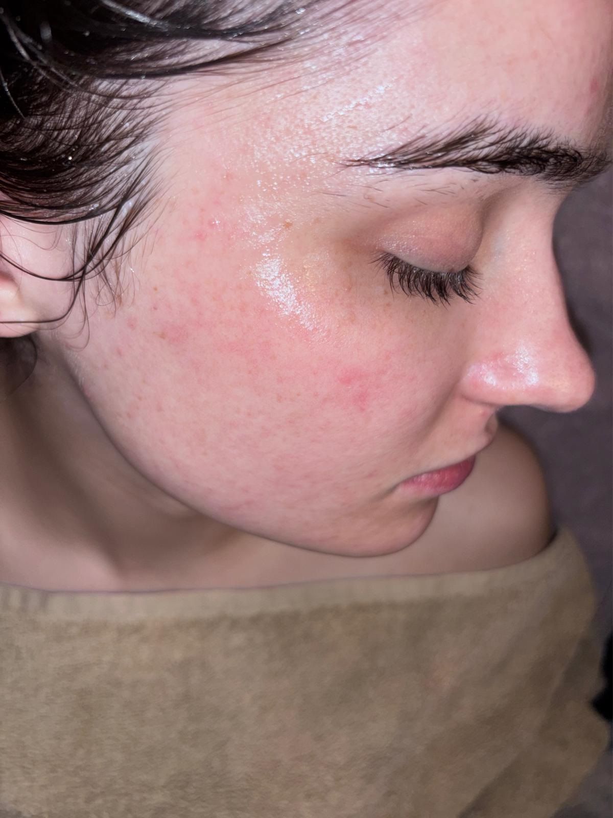 Client in profile with dewy, glowing skin after a facial