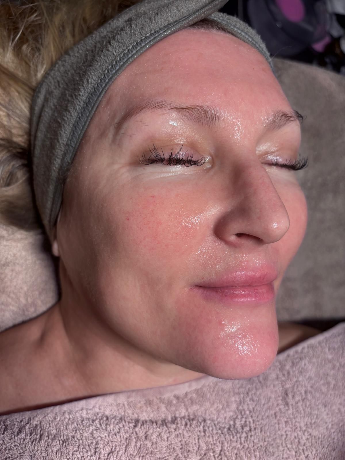 Client with luminous, rosy skin after a deluxe facial
