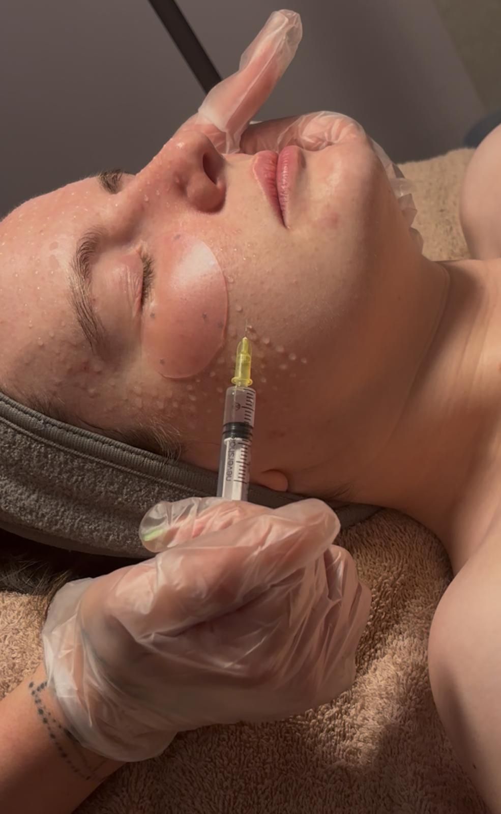 Skin booster serum being delivered to the skin